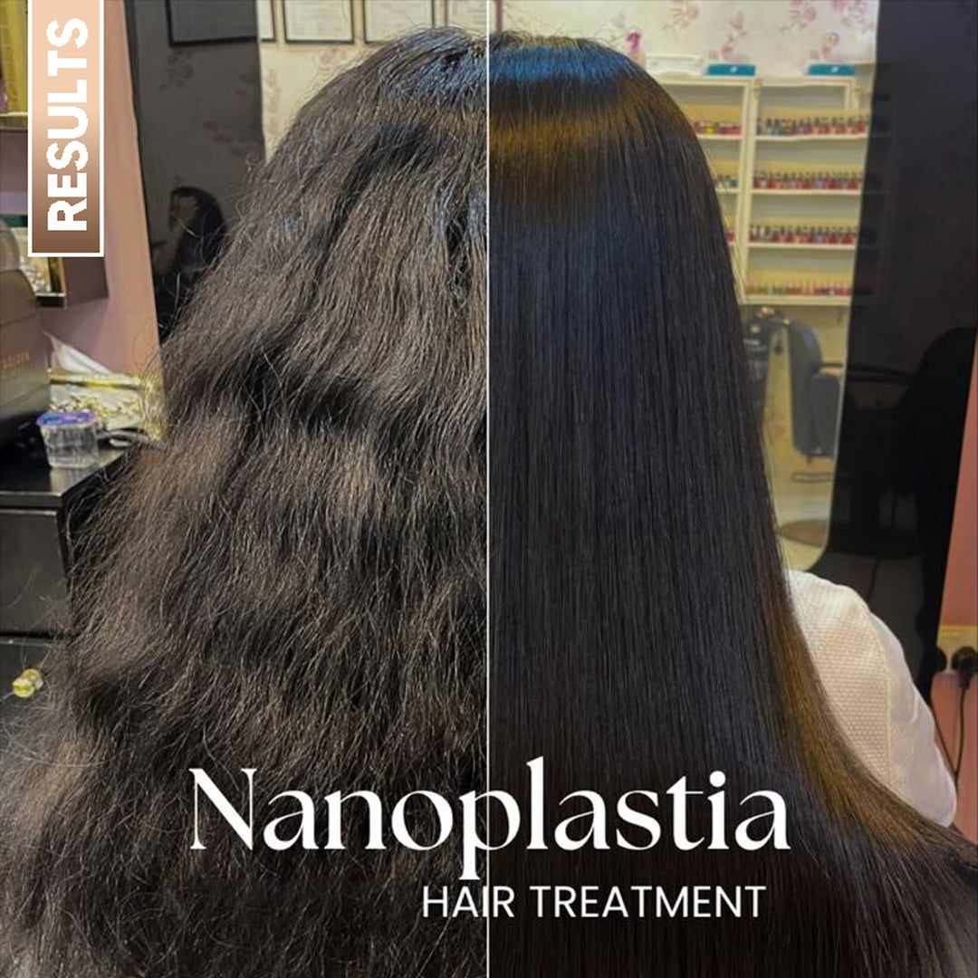 Super Active Urea Nanoplastia | Zero Formaldehyde Hair Smoothening Treatment | 100% Frizz Free | Brilliant Shine | 100 ml